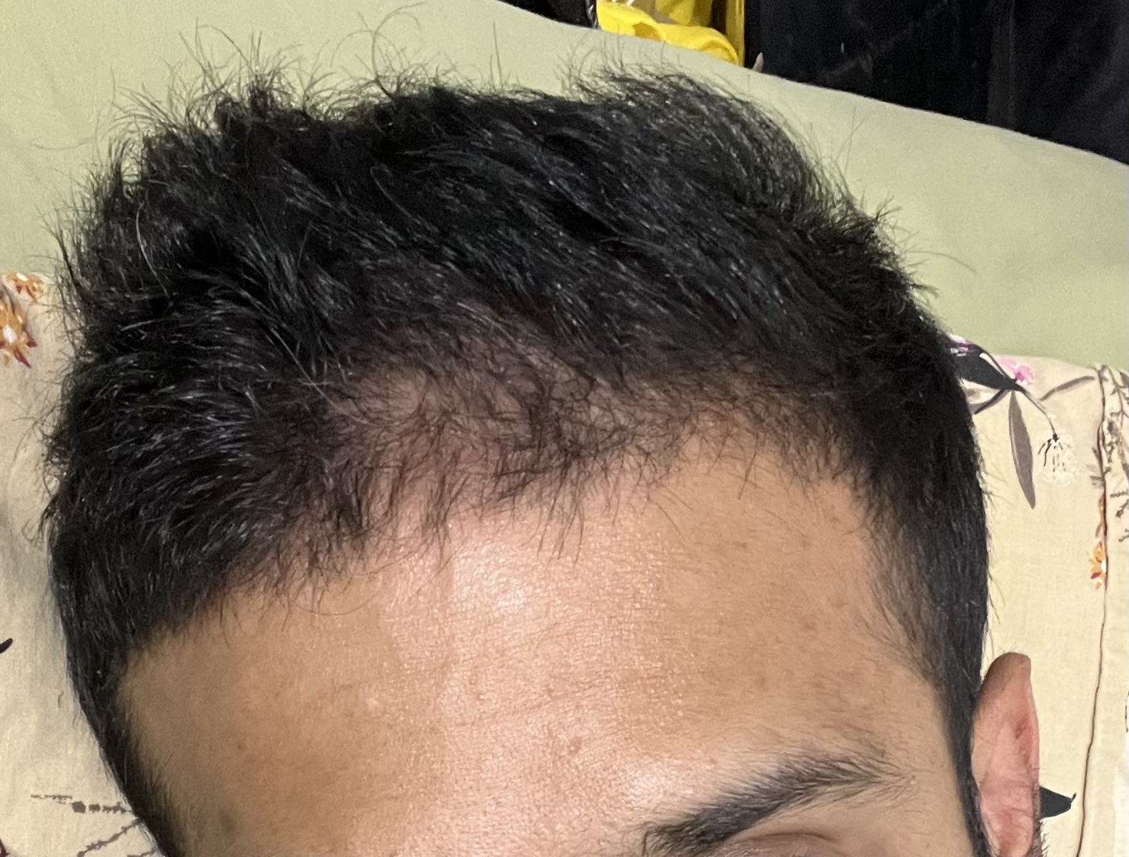 After