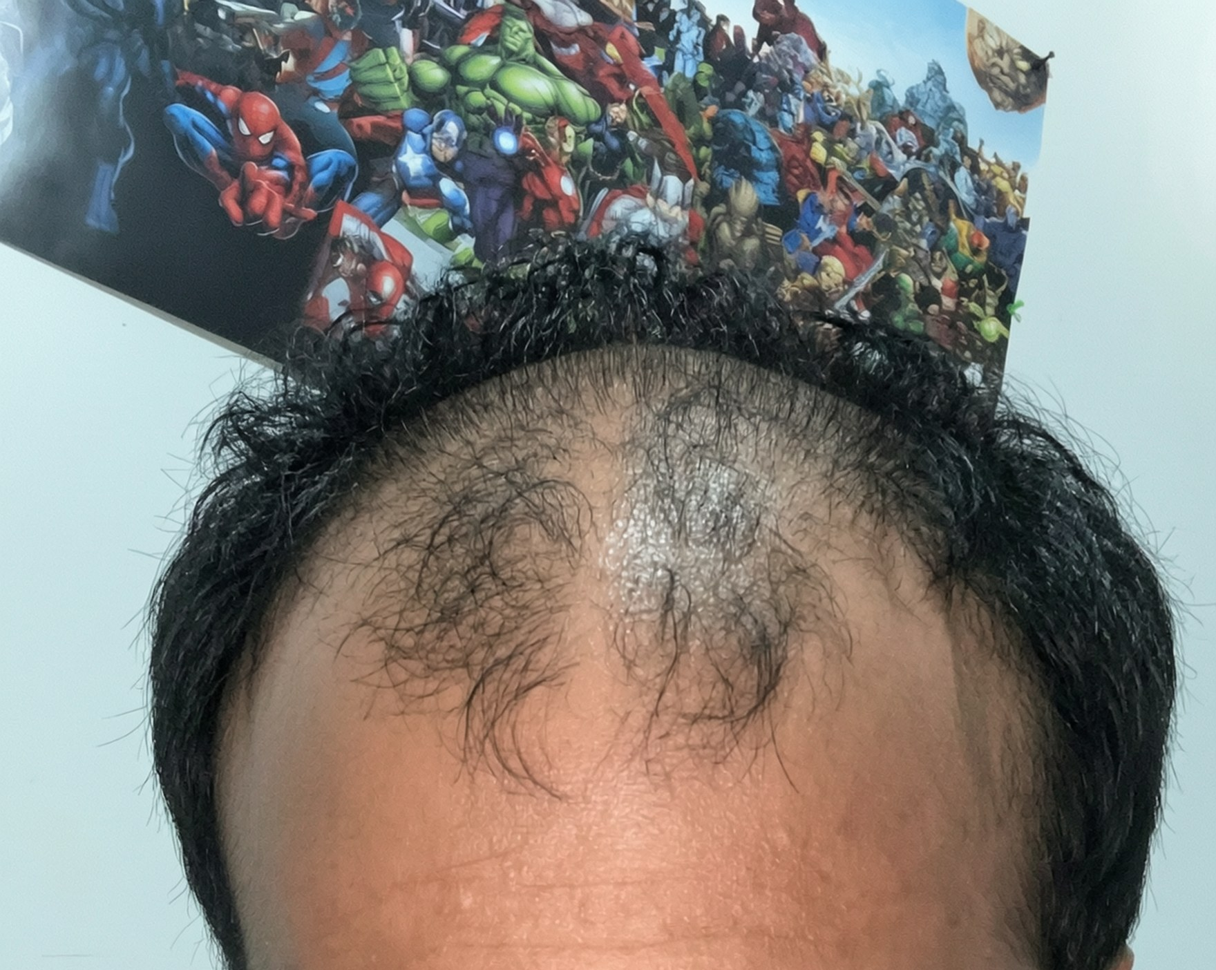 Before