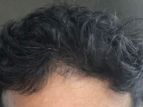 Best Hairstyles for Men with Thin Hair