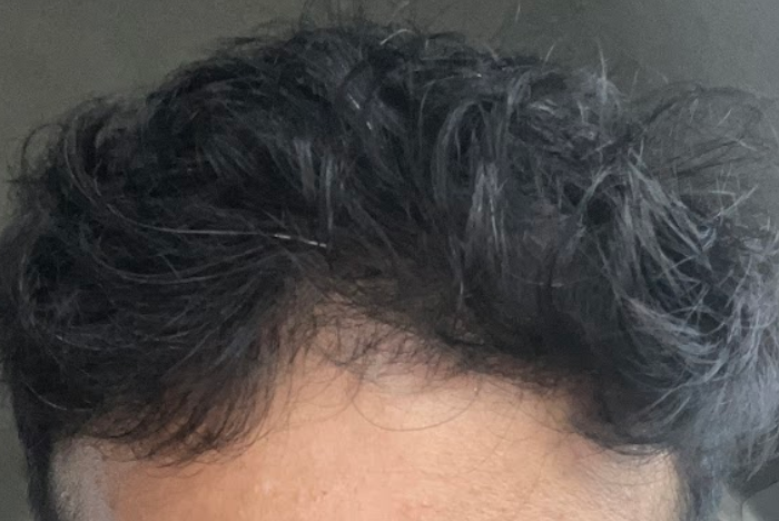 Best Hairstyles for Men with Thin Hair