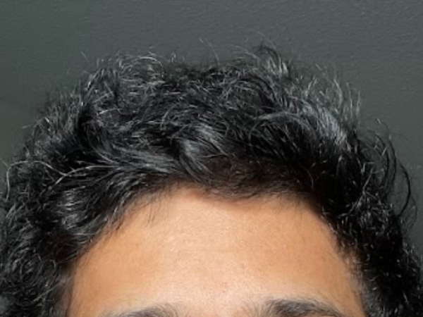 How to Make Thin Hair Thicker