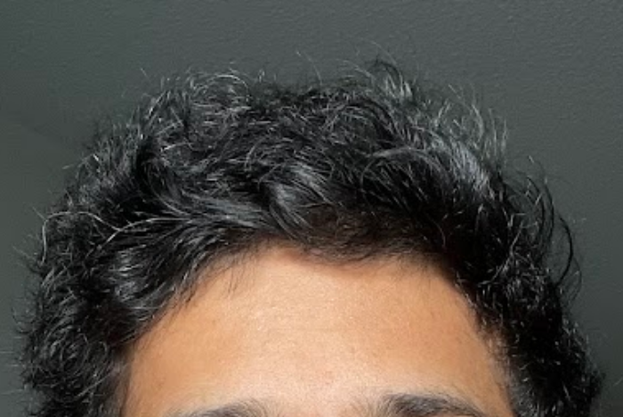 How to Make Thin Hair Thicker