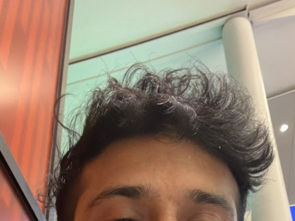 what does it mean when your hair is thinning