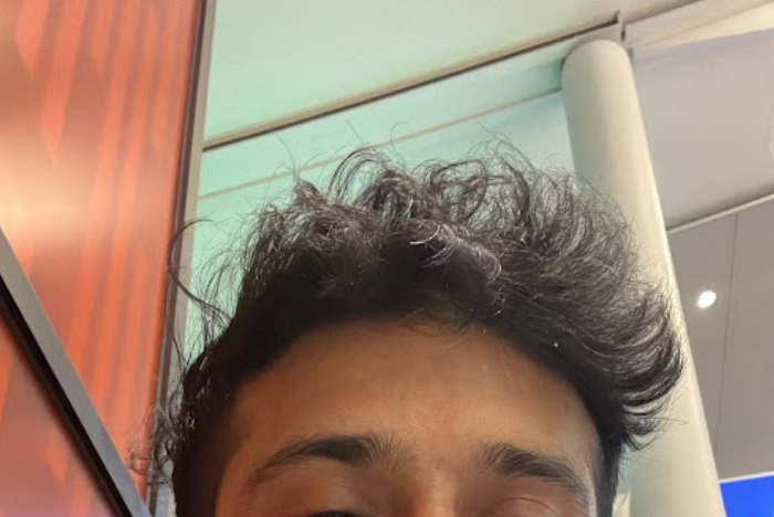 what does it mean when your hair is thinning