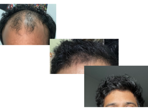 Before anda after hair care