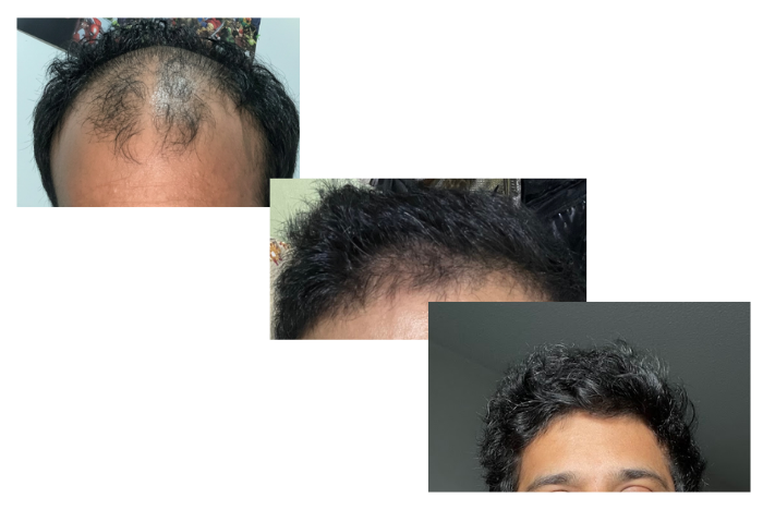 Before anda after hair care