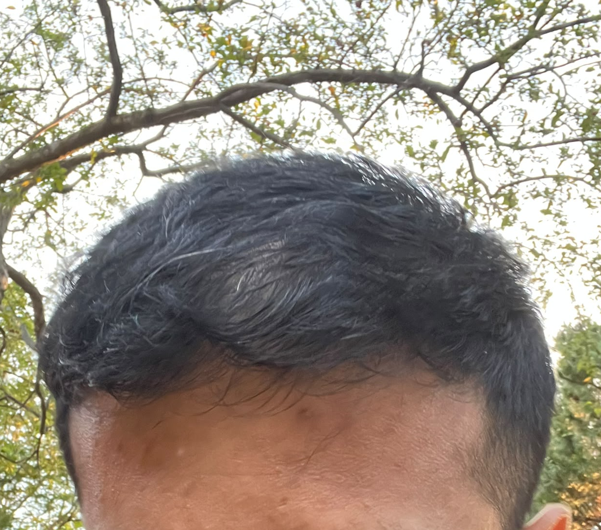 Checking out my thin hair and bald spot outside