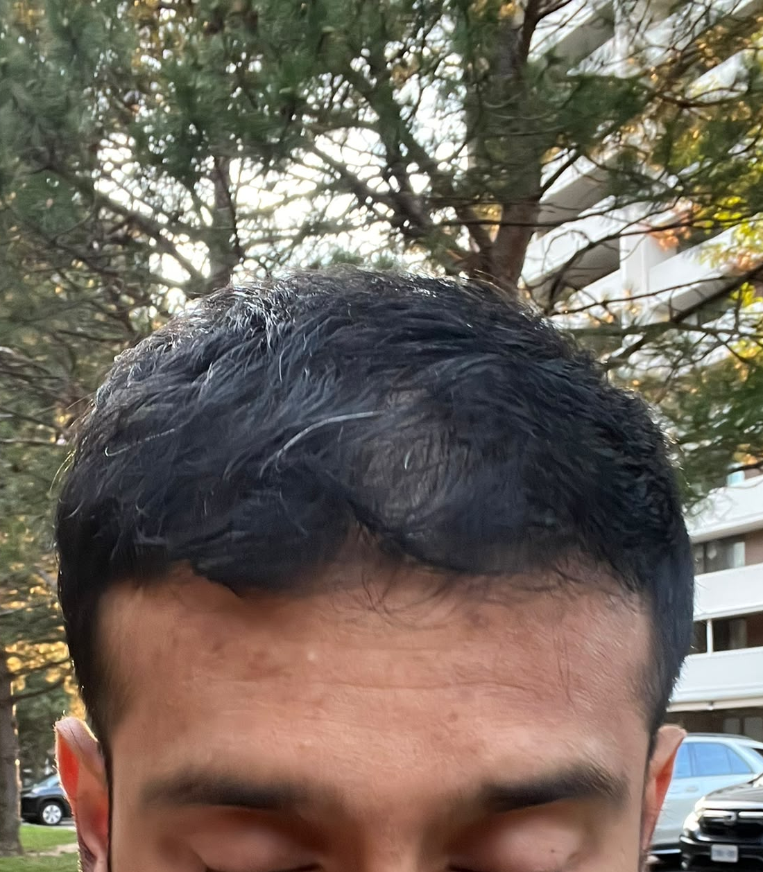 Another picture of me checking out my thin hair outside