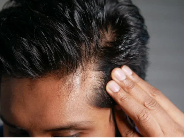 Fine Hair vs Thin Hair The Difference & Why It Matters
