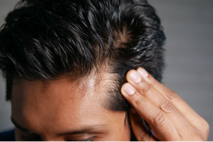 Fine Hair vs Thin Hair The Difference & Why It Matters